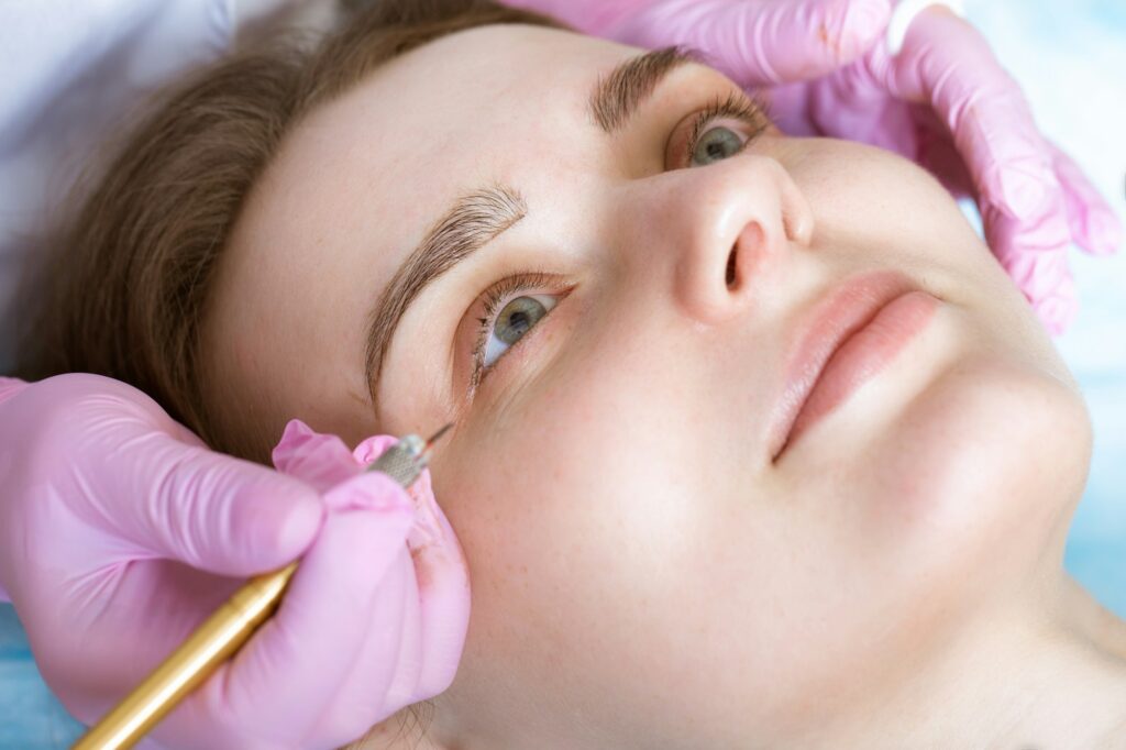 Permanent microblasting tattooing freckles to a woman in a beauty salon